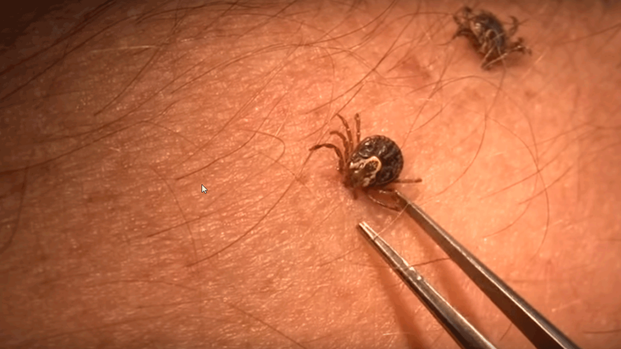 Lyme Disease From Ticks, STD’s & Cat Scratch Fever? The Best And